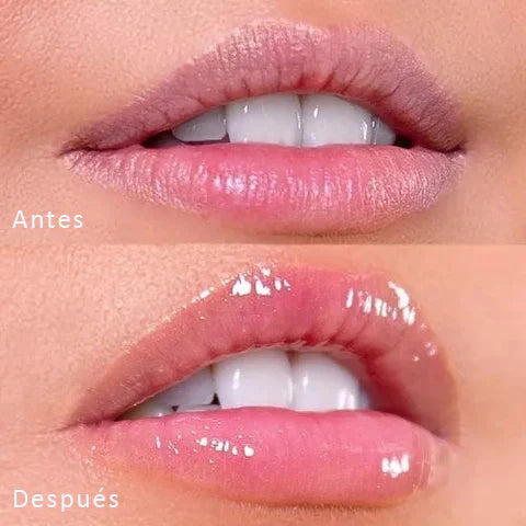 VOLUMINIZADOR DE LABIOS